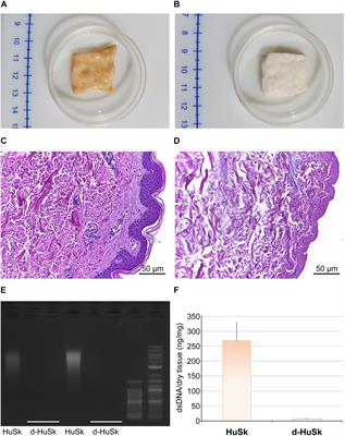 Decellularized Human Dermal Matrix as a Biological Scaffold for Cardiac Repair and Regeneration